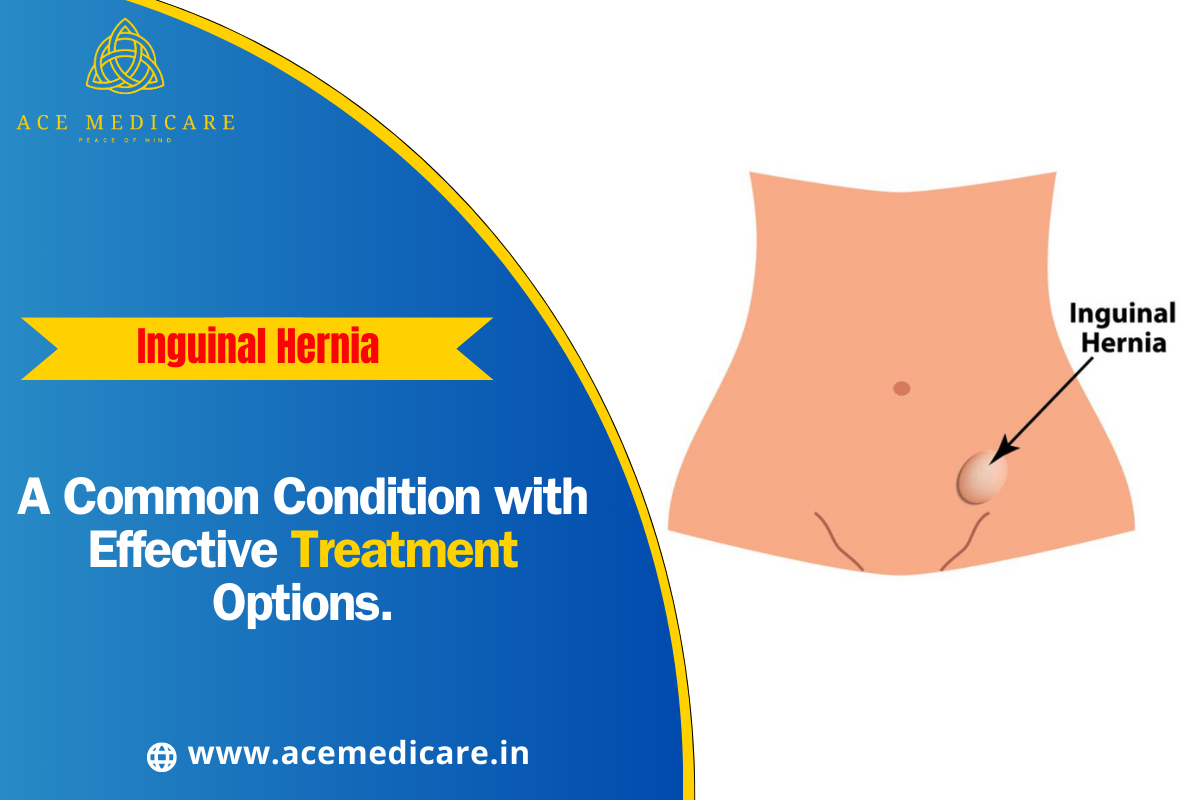 Inguinal Hernia: A Common Condition with Effective Treatment Options